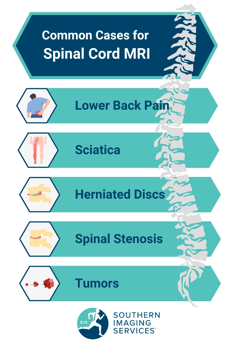 Spinal Cord Imaging