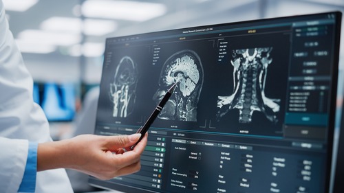 Proper Diagnosis After a Car Accident: Why It's Important