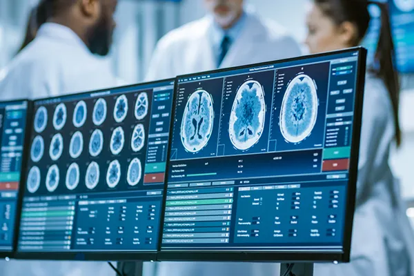 MRI for Brain Scans